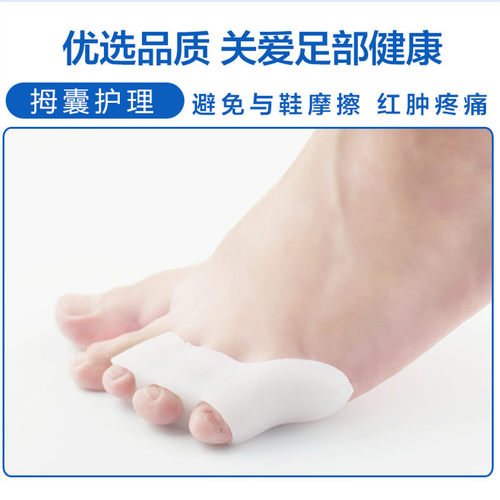 小脚重叠分离护理套外翻矫正器