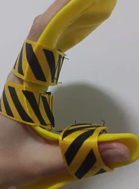 分指器手指痉挛畸形矫正器