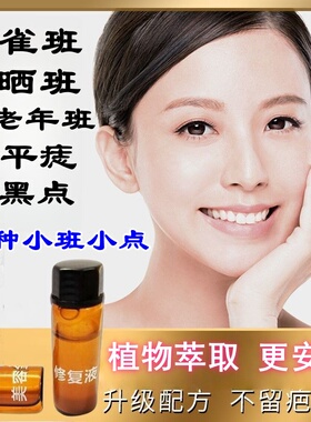 古方植物美容金水点斑去志药水