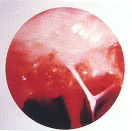 宝贝包括软件一套（一张光盘）+一只加密锁。可以远程协助安装或者电话指导、远程协助或者电话咨询有关软件的疑难问题。使用加密锁可以保证软件在不同机器安装，例如工作一段时间以后如果电脑损坏，只要加密锁正常，就可以更换新的电脑安装。