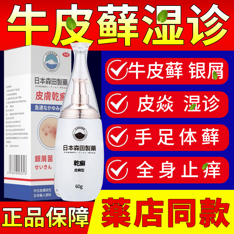 日本森田制药牛皮癣银屑病湿疹荨麻疹止痒特效药皮肤瘙痒手足头藓