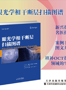 眼光学相干断层扫描图谱