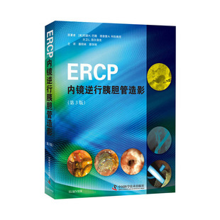 ERCP内镜逆行胰胆管造影