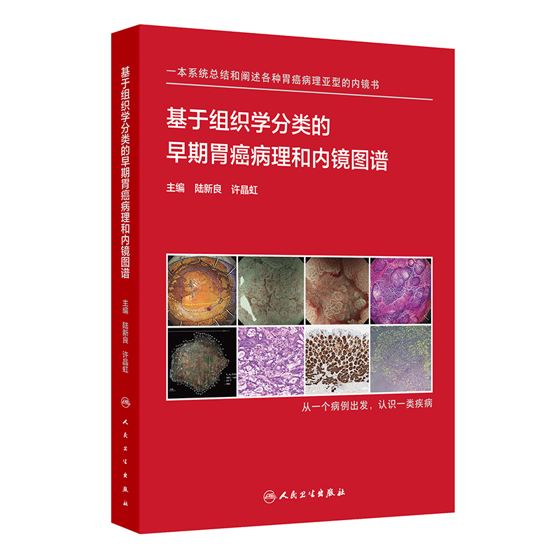 基于组织学分类的早期胃癌病理和内镜图谱