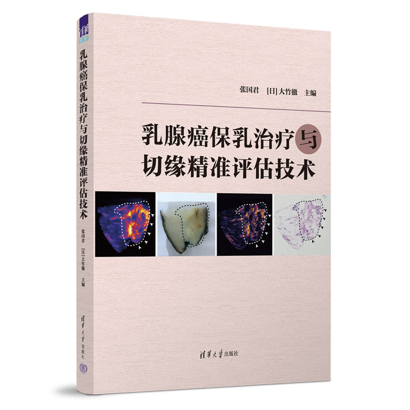 乳腺癌保乳治疗与切缘精准评估技术使用感如何?