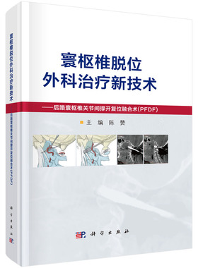 寰枢椎脱位外科治疗新技术--后路寰枢椎关节间撑开复位融合术（PFDF）