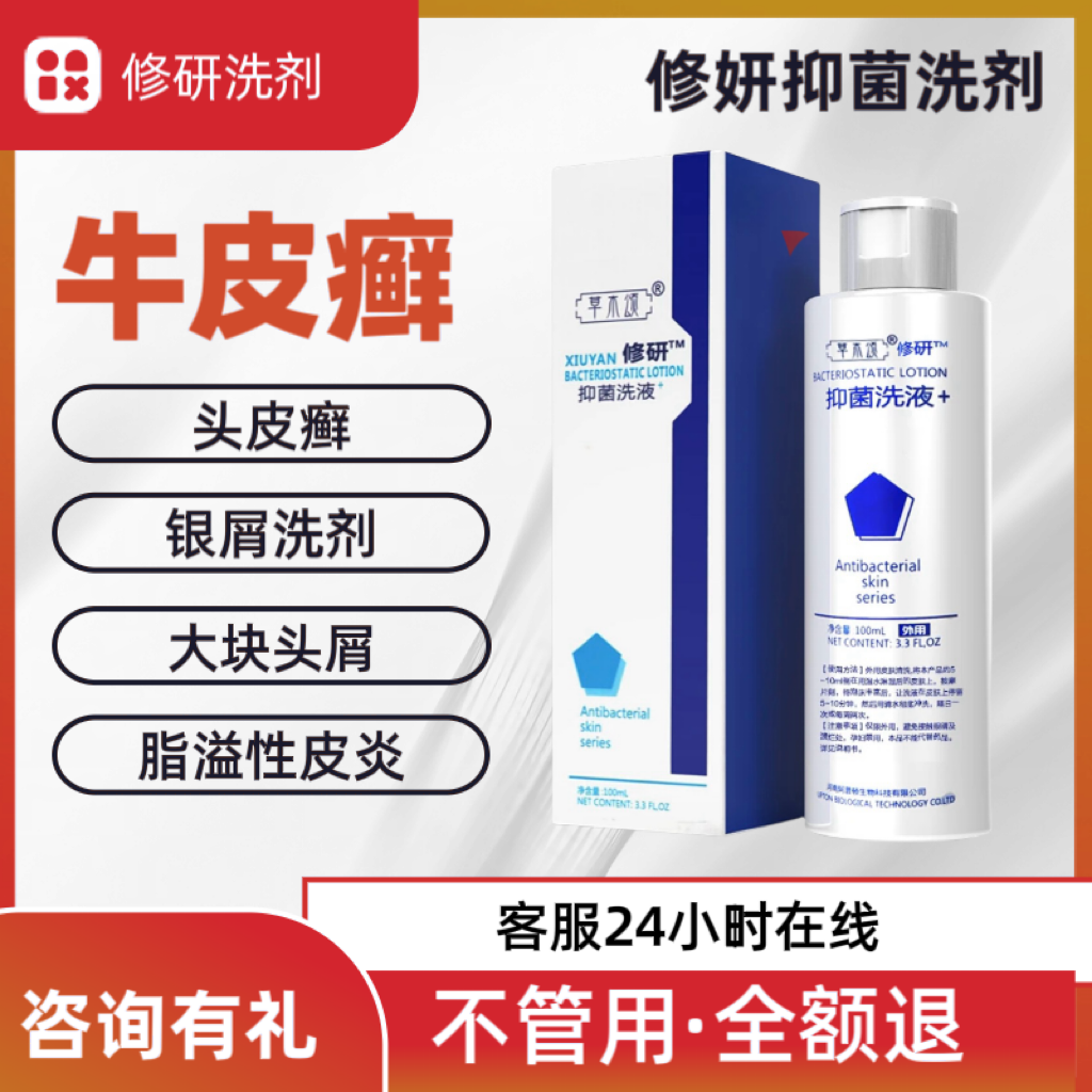 洗发水牛皮藓脂溢性皮炎银屑病