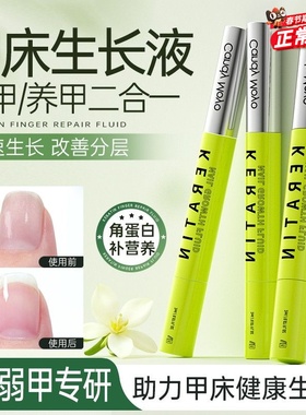 CandyMoyo护甲油指甲护理营养油生长水笔 强韧甲面指缘油增长液31