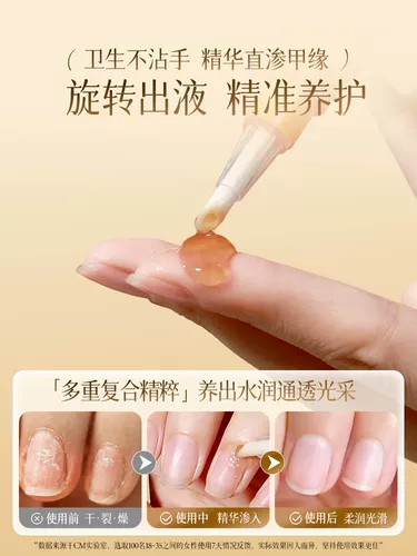 CandyMoyo, эссенция для ногтей, отшелушивающий питательный раствор, питательное масло