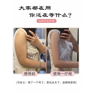 快速去手臂神器大粗胳膊细蝴蝶减拜拜肉粗粗臂女神贴 多买多送