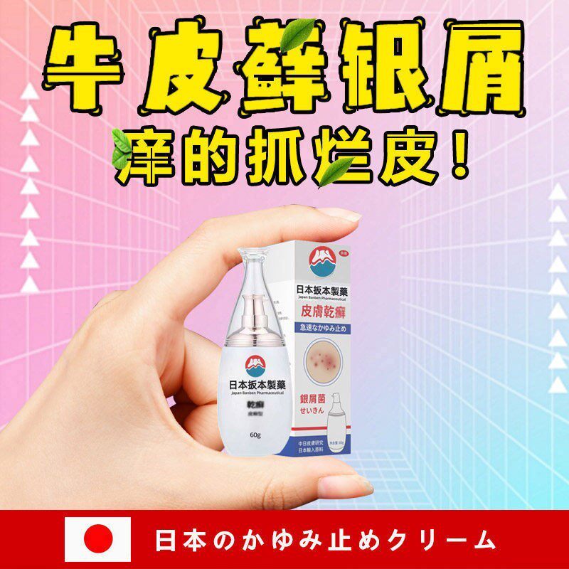日本进口配方皮癣型快速止皮肤痒湿痒膏牛皮癣湿诊荨麻疹皮焱干痒