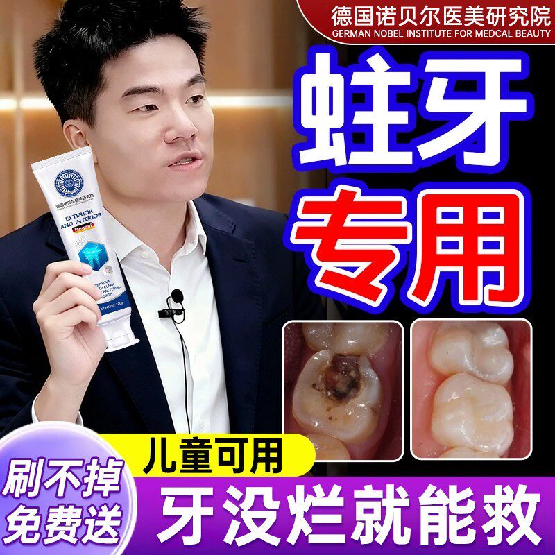 蛀牙龋齿修复牙洞自己补虫牙烂牙儿童清理药防蛀抗敏含氟成人专用