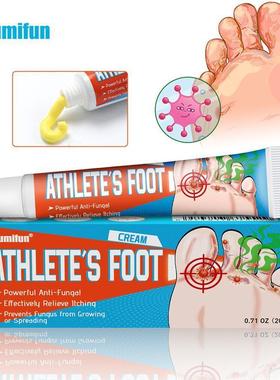 Athletes Foot Cream Effectively Relieve Itching