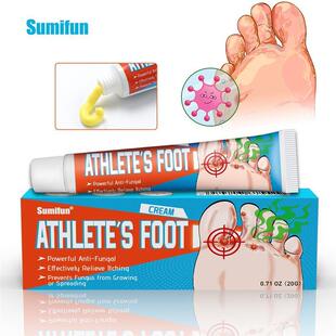 Athletes Foot Cream Effectively Relieve Itching