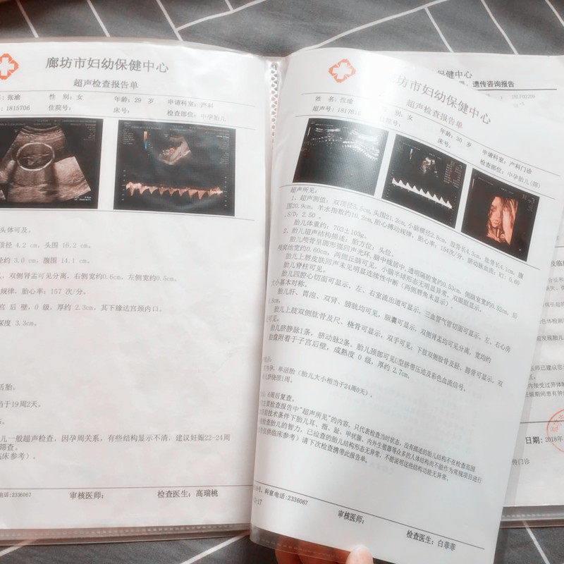 Pregnant mother Check- Pregnancy test data Storage Clinic B-mode ultrasonography file pregnant woman pregnancy Check- record Assay inspectin the Electronic Dictionary/Electronic paper book/Stationery , Shelves/Display items , Information Booklet  category - from Buy2taobao.com to provide professional Taobao agent buy service