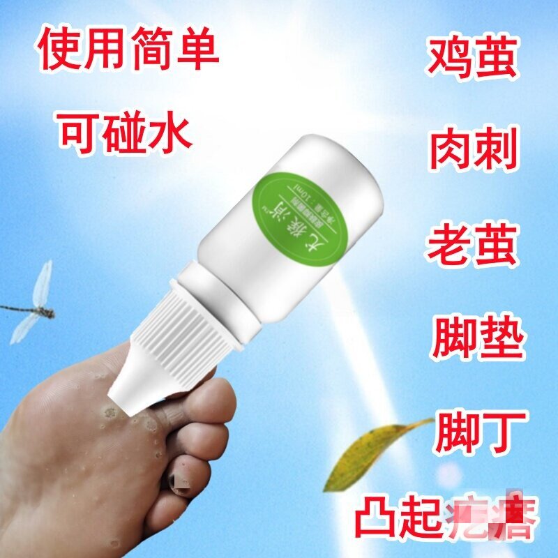 消正品肉刺去除膏鱼鳞痣膏去肉刺猴茧子去猴的药丝条甲周趾手足