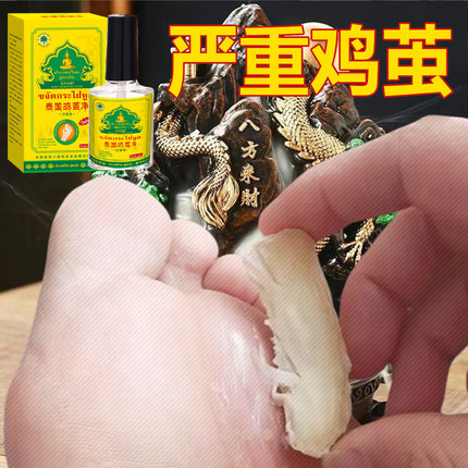 【自然脱落】老茧脚茧关节茧手茧脚底老茧厚茧脚垫