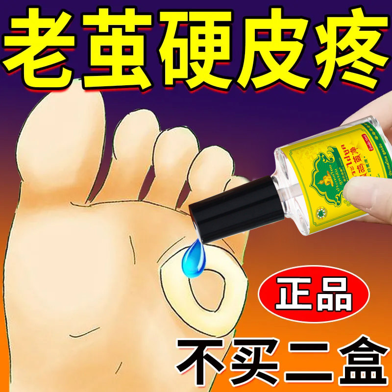 【自然脱落】老茧脚茧关节茧手茧身体乳液
