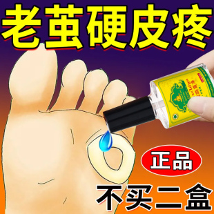 【自然脱落】老茧脚茧关节茧手茧脚底老茧厚茧专用脚垫