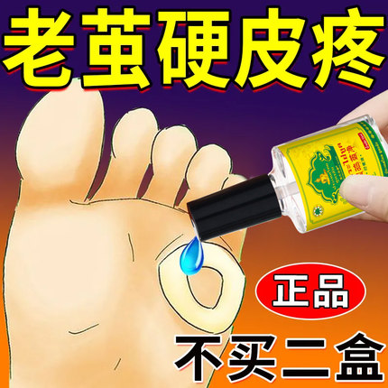 【自然脱落】老茧脚茧关节茧手茧脚底老茧厚茧专用脚垫