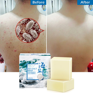 除螨皂去螨虫全身海盐皂Sea Salt Soap Cleaner  Acne Treatment