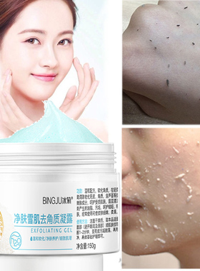 去角质凝露啫喱去死皮洁面膏 Facial Exfoliating Peeling Gel