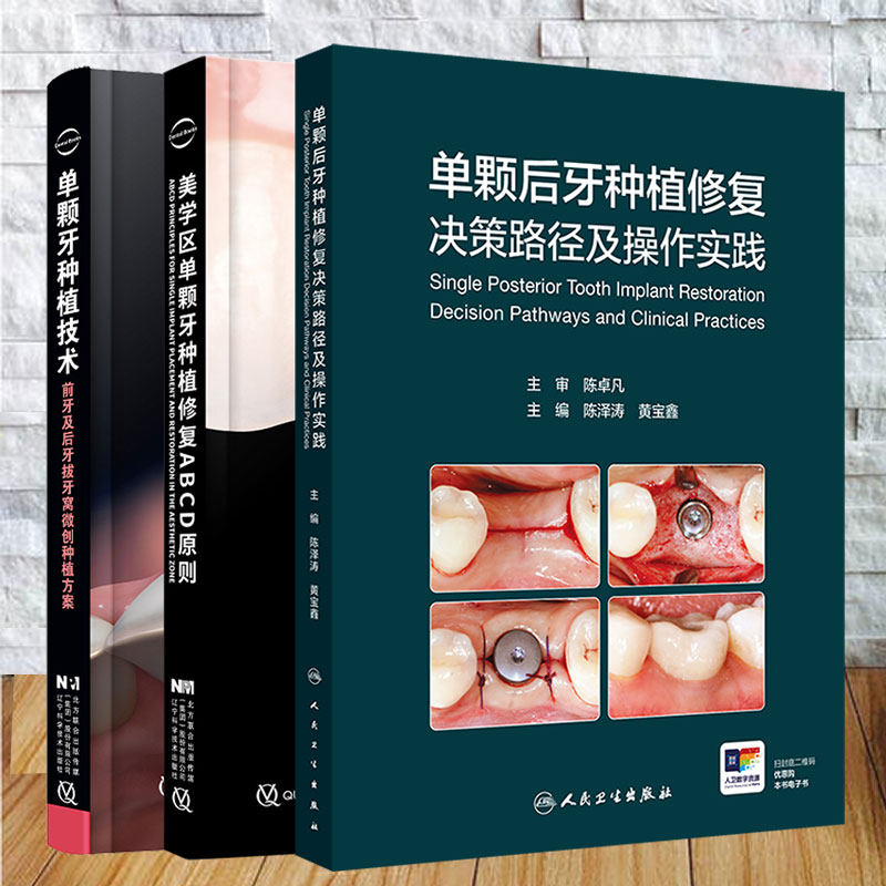 3本套 单颗后牙种植修复决策路径及操作实践/美学区单颗牙种植修复ABCD原则/单颗牙种植技术前牙及后牙拔牙窝微创种植方案陈泽涛等