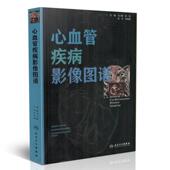 人民卫生出版 马小静主编 社 心血管疾病影像图谱 现货