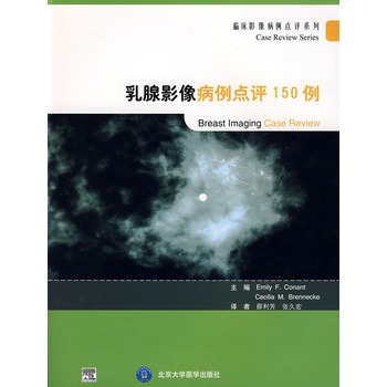 乳腺影像病例点评150例 书籍/杂志/报纸 妇产科学 原图主图