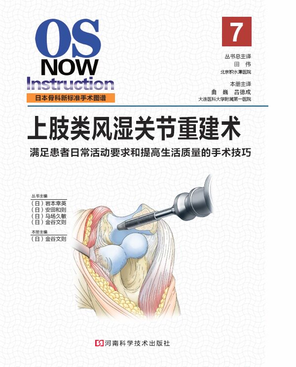 日本骨科新标准手术图谱:上肢类风湿关节重建术