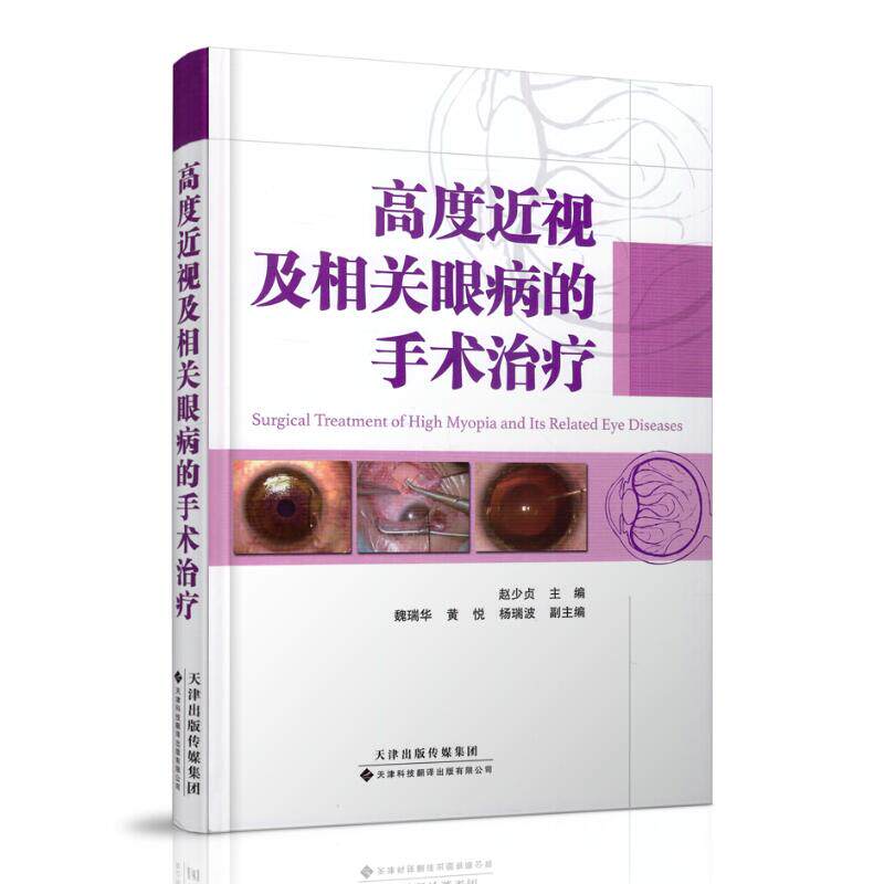 正版现货 高度近视及相关眼病的手术治疗 赵少贞主编 天津科技翻译出版社