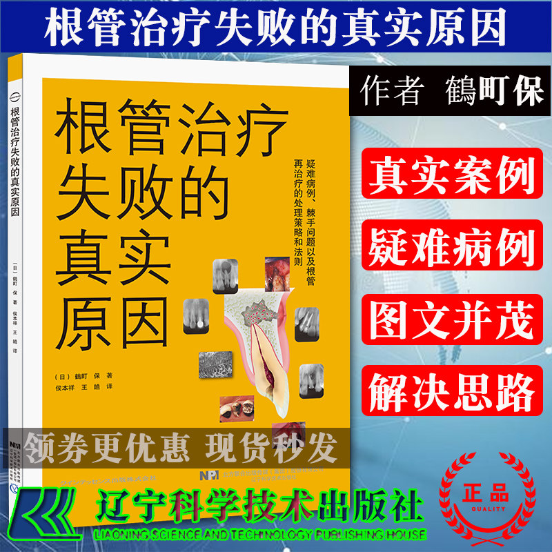 现货根管治疗失败的真实原因辽宁科学技术出版社临床医学口腔科牙体牙髓病预防诊断治疗教程牙齿种植畸形矫正手术技巧根管工具