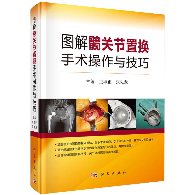 现货图解髋关节置换手术操作与技巧 王坤正 张先龙 科学出版社9787030656667