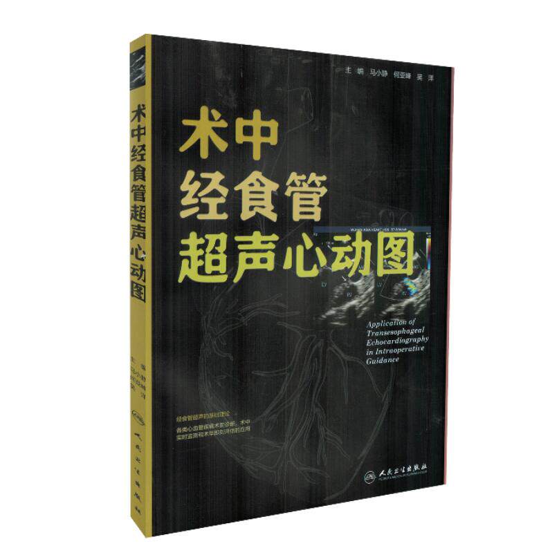 goods in stock Esophagus Echocardiogram Editor-in-chief Ma Xiaojing the people Health Pressin the Books/Magazine/Newspaper , Medical Health , Medical Atlas  category - from Buy2taobao.com to provide professional Taobao agent buy service