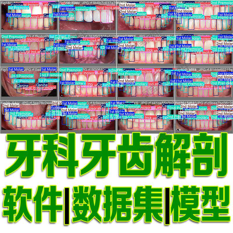 yolo牙科解剖学牙齿数据集模型python标注机器深度学习自动识别