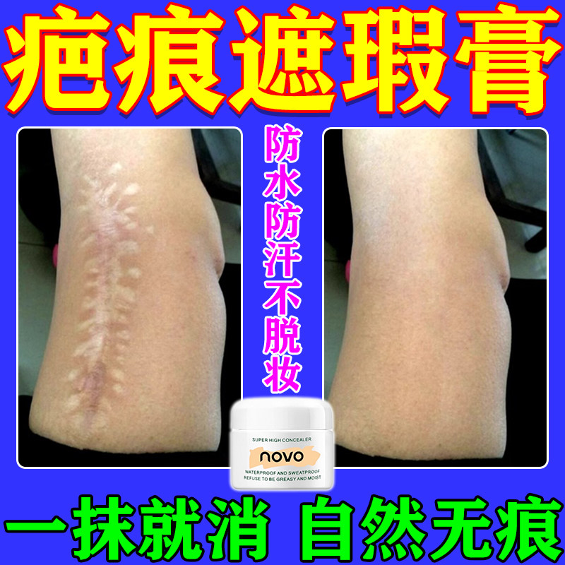 防水疤痕遮瑕膏高清明净