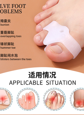 矫正器指外翻分趾器双环分趾
