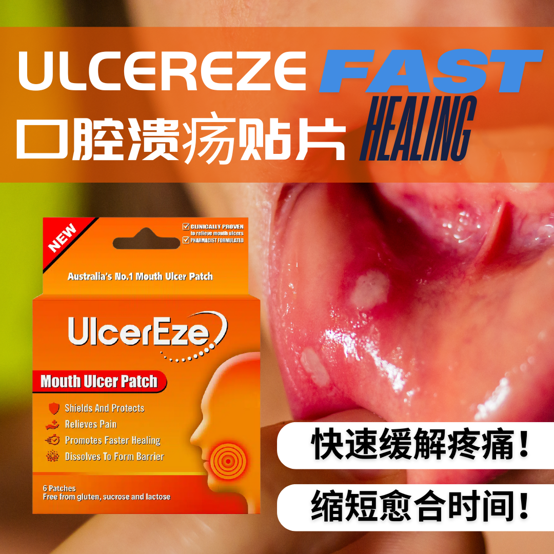 澳洲ULCEREZE口腔溃疡贴片缓解口疮口舌溃疡加速愈合缓解疼痛6片,保健用品,口腔健康,淘宝优惠券,粉丝福利购,淘宝优惠卷