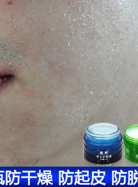 男面霜洗脸后涂擦脸油嘴边防干燥脱皮秋冬天鼻子天冷起皮干裂爆皮