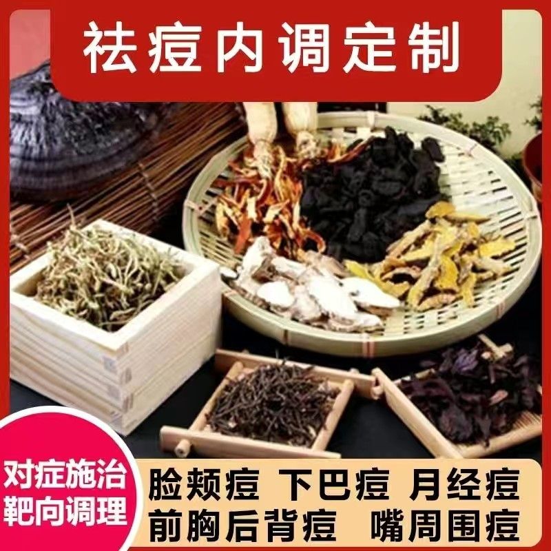 免煎熬祛痘内服粉刺痤疮青