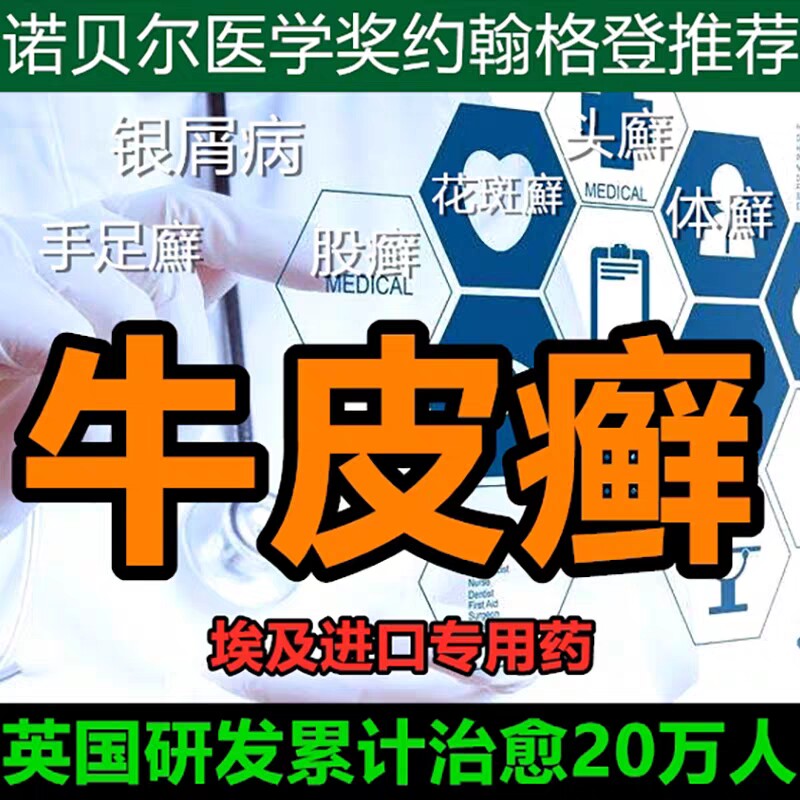 埃及美肤膏牛皮癣特效银屑手足癣体股藓瘙痒汗疱湿疹止痒进口药膏