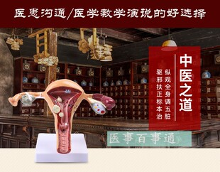 人体子宫解剖模型子宫模型子宫癌变输卵管狭窄综合疾病科普教育
