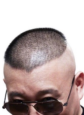 郭德纲同款理发自己剪模具成人辅助发型模型模具头型大人头顶造型