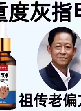 正品李时珍灰甲净无痛去灰脚趾指甲增厚甲沟焱抑菌亮甲液特效