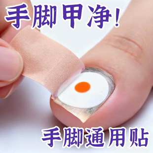 专用贴植物萃取脚趾手指甲专用修护 杀真菌指甲贴正品 香港专研