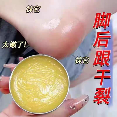 脚后跟干裂防裂膏手足皴裂皲裂膏补水保湿滋润脚润养霜脚跟修护霜