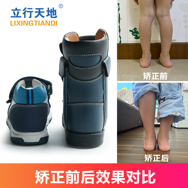 外八字内八字足弓垫高帮矫正鞋