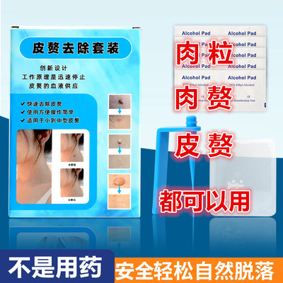 物理去肉粒肉赘丝尤皮赘
