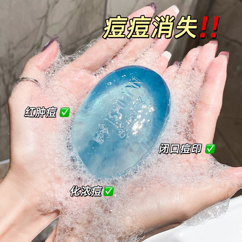 水杨酸皂祛痘洗澡控油除螨皂香皂全身背后祛痘深层清洁手工洁面皂