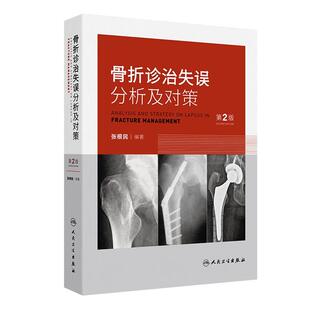 骨折诊治失误分析及对策 第2版